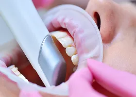 プライムスキャン