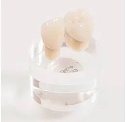 メタルセラミック