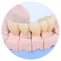 セラミック・審美治療